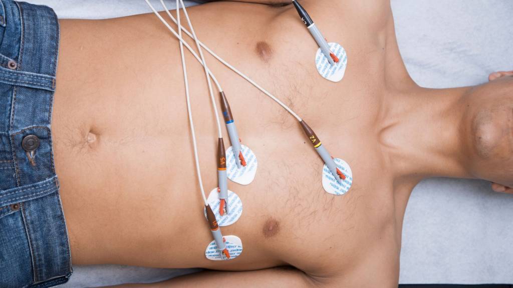 ekg gliwice