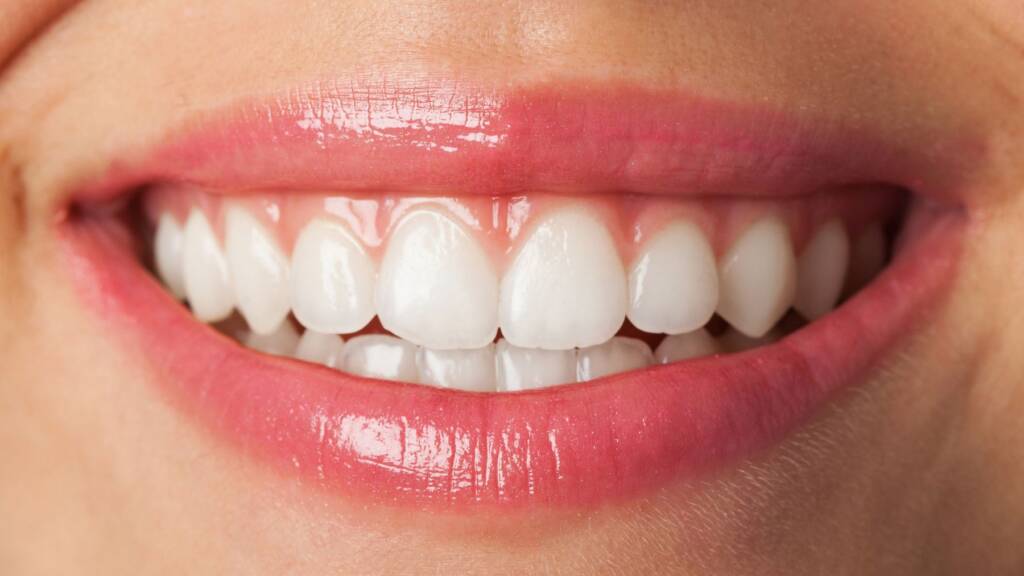 Guided Biofilm Therapy (GBT)